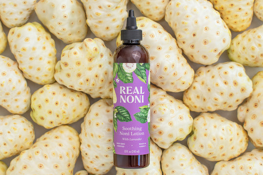 soothing lavender noni lotion for your skin condition relief